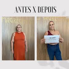 Antes e depois - resultado real de paciente